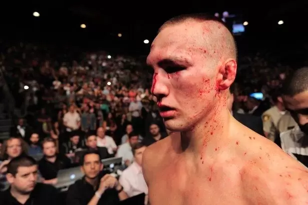 Дуглас Лима - Рори МакДональд. Прогноз и ставки на бой MMA (21.01.2017) Дуглас Лима - Рори МакДональд. Прогноз и ставки на бой MMA (21.01.2017)